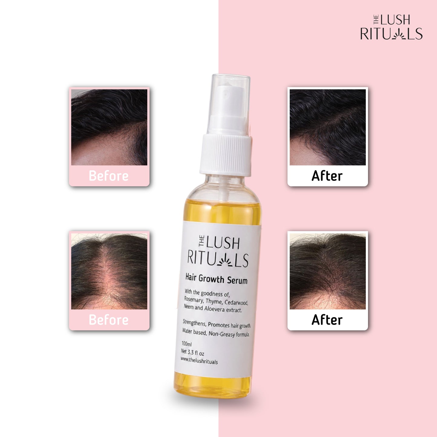 Hair Growth Serum